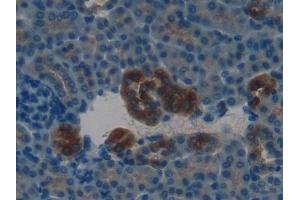 Immunohistochemistry (IHC) image for anti-Kallikrein-Related Peptidase 4 (KLK4) (AA 32-255) antibody (ABIN7431806)