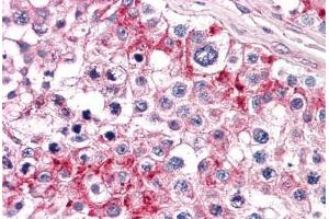 Human Testis: Formalin-Fixed, Paraffin-Embedded (FFPE) (TLN1 antibody  (AA 1052-1150))