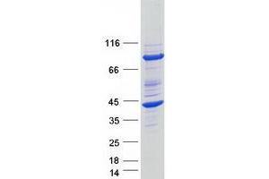 Validation with Western Blot (FKBP6 Protein (Transcript Variant 1) (Myc-DYKDDDDK Tag))