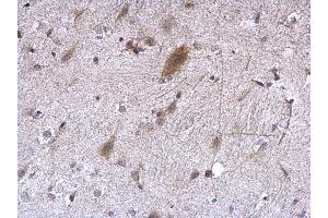 IHC-P Image EEF1E1 antibody [N1C3] detects EEF1E1 protein at cytoplasm on mouse fore brain by immunohistochemical analysis. (EEF1E1 antibody)