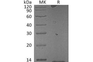 Western Blotting (WB) image for S100 Calcium Binding Protein A7A (S100A7A) protein (ABIN7320634) (S100A7A Protein)