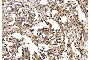 IHC analysis of Profilin 2/PFN2 using anti-Profilin 2/PFN2 antibody (ABIN7602692). (PFN2 antibody  (AA 96-138))