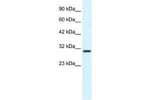 WB Suggested Anti-FLJ20729 Antibody Titration:  1. (FLJ20729 (C-Term) antibody)