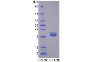 SDS-PAGE (SDS) image for Sonic Hedgehog (SHH) ELISA Kit (ABIN6574290)