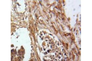 Used in DAB staining on fromalin fixed paraffin-embedded Ovary tissue (Inhibin alpha antibody  (AA 25-363))