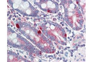 MED4 antibody was used for immunohistochemistry at a concentration of 4-8 ug/ml. (MED4 antibody  (Middle Region))