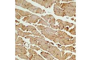 Immunohistochemical analysis of Beta3-tubulin staining in mouse skeletal muscle formalin fixed paraffin embedded tissue section. (TUBB3 antibody)