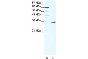 Western Blotting (WB) image for anti-Melanoma Antigen Family A, 9 (MAGEA9) antibody (ABIN2461754) (MAGEA9 antibody)