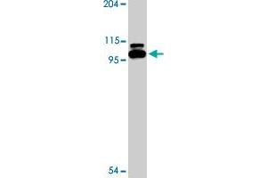 Western blot analysis of TLR6 expression in Jurkat cell lysate with TLR6 polyclonal antibody  at 2 ug/mL . (TLR6 antibody  (Internal Region))