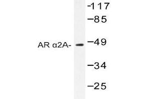 Western blot (WB) analysis of AR alpha2A antibody in extracts from Jurkat cells. (ADRA2A antibody)