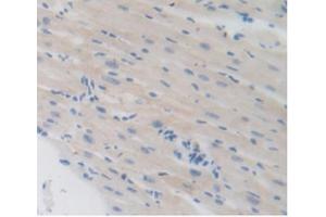 IHC-P analysis of Mouse Heart Tissue, with DAB staining. (LSR antibody  (AA 35-205))