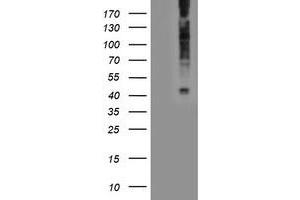 HEK293T cells were transfected with the pCMV6-ENTRY control (Left lane) or pCMV6-ENTRY LPAR1 (Right lane) cDNA for 48 hrs and lysed. (LPAR1 antibody)