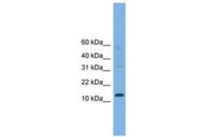 Image no. 1 for anti-Cellular Retinoic Acid Binding Protein 2 (CRABP2) (AA 35-84) antibody (ABIN6744711) (CRABP2 antibody  (AA 35-84))