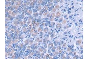 DAB staining on IHC-P; Samples: Mouse Stomach Tissue (PLEKHA1 antibody  (AA 105-351))