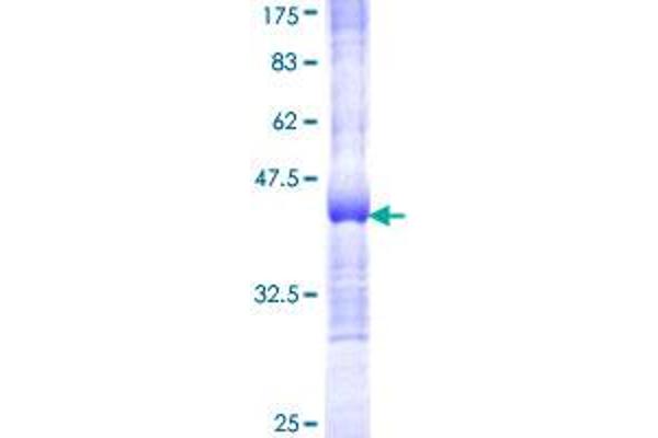 Phenylalanyl-tRNA Synthetase, alpha Subunit (FARSA) (AA 101-201) protein (GST tag)