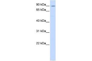 ATP2C1 antibody used at 1 ug/ml to detect target protein. (ATP2C1 antibody  (C-Term))