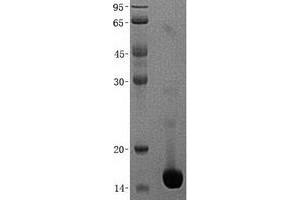 Western Blotting (WB) image for NHP2 Non-Histone Chromosome Protein 2-Like 1 (NHP2L1) (Transcript Variant 2) protein (His tag) (ABIN2727263)