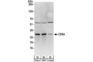 Western Blotting (WB) image for anti-Cyclin-Dependent Kinase 4 (CDK4) (AA 253-303) antibody (ABIN7455013)