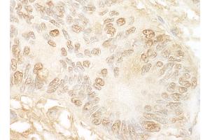 Immunohistochemistry (IHC) image for anti-Junction Mediating and Regulatory Protein, P53 Cofactor (JMY) (AA 1-50) antibody (ABIN7454459)