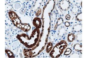 Image no. 5 for anti-Adenylate Kinase 5 (AK5) antibody (ABIN1496535) (Adenylate Kinase 5 antibody)