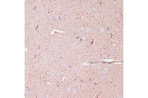 Immunohistochemistry of paraffin-embedded mouse brain using CD82 antibody (ABIN6131855, ABIN6138233, ABIN6138234 and ABIN6218884) at dilution of 1:100 (40x lens). (CD82 antibody  (C-Term))