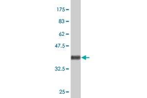 Western Blot detection against Immunogen (38. (Macrophage Mannose Receptor 1 antibody  (AA 22-130))