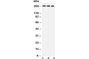 Western blot testing of BRCA1 antibody and Lane 1:  HeLa;  2: MCF-7;  3: A549 lysate (BRCA1 antibody  (AA 1661-1863))