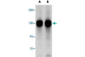 Western blot analysis of FAM120A in SK-N-SH cell lysate with FAM120A polyclonal antibody  at (A) 0. (FAM120A antibody  (Internal Region))