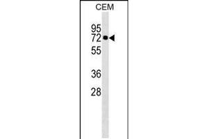 Western blot analysis in CEM cell line lysates (35ug/lane). (KLHL28 antibody  (C-Term))