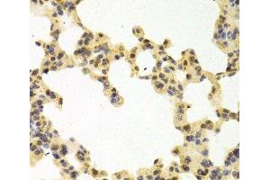 Immunohistochemistry of paraffin-embedded Mouse lung using RANGAP1 Polyclonal Antibody at dilution of 1:100 (40x lens). (RANGAP1 antibody)
