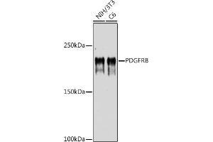 Western blot analysis of extracts of various cell lines, using PDGFRB antibody (ABIN6134579, ABIN6145372 and ABIN7101437) at 1:1000 dilution. (PDGFRB antibody)