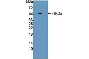 Detection of Recombinant STAM2, Mouse using Polyclonal Antibody to Signal Transducing Adaptor Molecule 2 (STAM2) (STAM2 antibody  (AA 1-377))