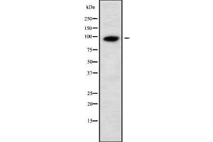 Western blot analysis UNC5A using Jurkat whole cell lysates (UNC5A antibody  (Internal Region))