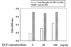 Image no. 5 for Epidermal Growth Factor Receptor (EGFR) ELISA Kit (ABIN1981825)