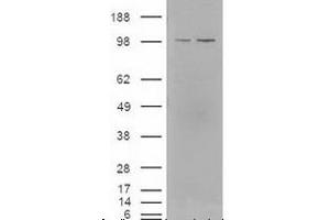 Western blot analysis of LXR in lysates of cells that were transfected with the pCMV6-ENTRY control or pCMV6-ENTRY NR1H3 cDNA using NR1H3/NR1H2 polyclonal antibody . (NR1H3 antibody  (AA 50-150))