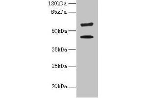 Western blot All lanes: KRT73 antibody at 4 μg/mL + HepG2 whole cell lysate Secondary Goat polyclonal to rabbit IgG at 1/10000 dilution Predicted band size: 59, 42 kDa Observed band size: 59, 42 kDa (KRT73 antibody  (AA 1-300))