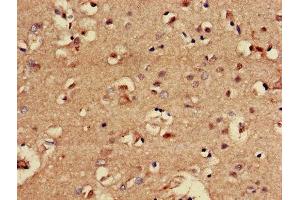 Immunohistochemistry of paraffin-embedded human brain tissue using ABIN7147705 at dilution of 1:100 (CBX5 antibody  (AA 1-191))