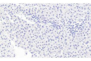 ABIN334436 Negative Control showing staining of paraffin embedded Human Liver, with no primary antibody. (MGLL antibody  (Internal Region))