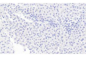 ABIN334436 Negative Control showing staining of paraffin embedded Human Liver, with no primary antibody.