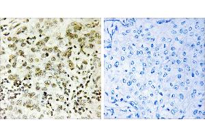 Peptide - + (CTDSP1 antibody)