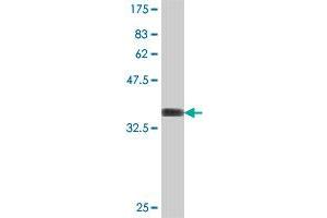 Western Blot detection against Immunogen (37 KDa) . (Rhotekin antibody  (AA 451-549))