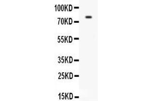 Anti-CD31 antibody, ,Western blottingAll lanes: Anti CD31  at 0. (CD31 antibody  (C-Term))
