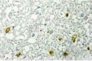 Immunohistochemistry (IHC) analyzes of FoxE1 antibody in paraffin-embedded human RAW264. (FOXE1 antibody)