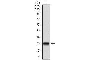 Western blot analysis using NT5E mAb against human NT5E (AA: ) recombinant protein. (CD73 antibody  (AA 30-250))