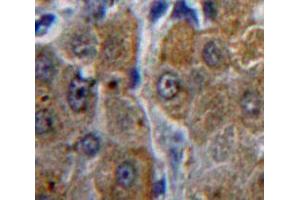 Used in DAB staining on fromalin fixed paraffin-embedded Liver tissue (ACP1 antibody  (AA 1-158))