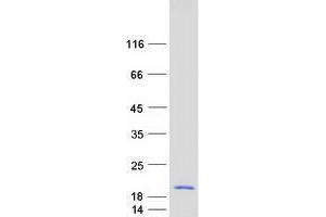 Validation with Western Blot (UQCRB Protein (Myc-DYKDDDDK Tag))