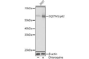 Western blot analysis of extracts of 293T cells, using SQSTM1/p62 Rabbit pAb (ABIN6128548, ABIN6148415, ABIN6148421 and ABIN6215125) at 1:1000 dilution. (SQSTM1 antibody  (AA 1-240))