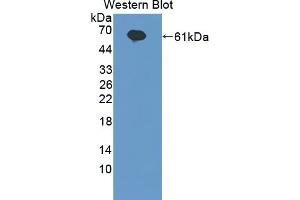 Western blot analysis of the recombinant protein. (IL20RA antibody  (AA 269-545))