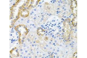 Immunohistochemistry of paraffin-embedded Rat kidney using STRN3 Polyclonal Antibody at dilution of 1:100 (40x lens). (STRN3 antibody)