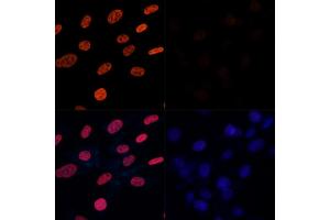 Immunofluorescence analysis of NIH-3T3 cells treated by TSA (upper left) and untreated NIH-3T3 cells(upper right) using Acetyl-Histone H3-K27 Rabbit pAb (red, ABIN7267670) at dilution of 1:100. (Histone 3 antibody  (H3K27))